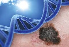 Skin Cancer And Genetics