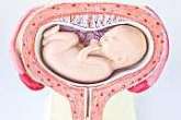 amniotic fluid embolism most common sites