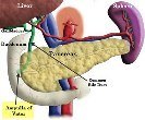 Ampullary Cancer