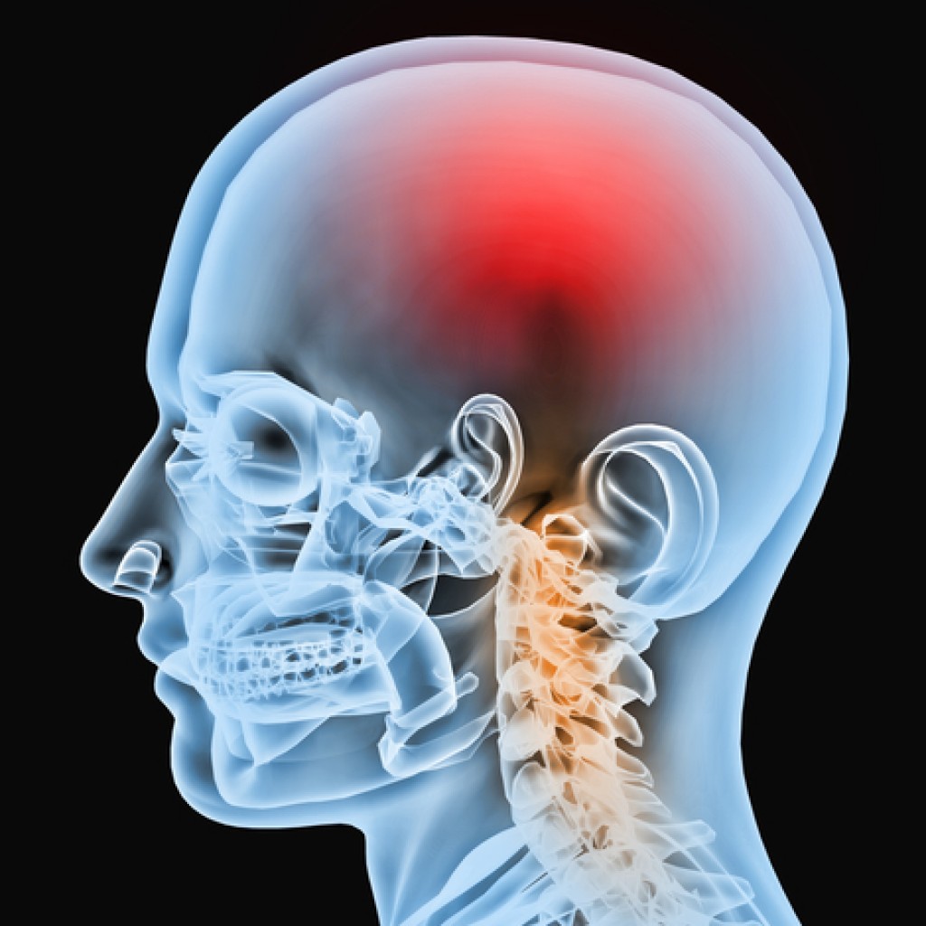 Amyotrophic Lateral Sclerosis