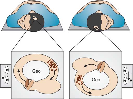 benign-paroxysmal-positional-vertigo