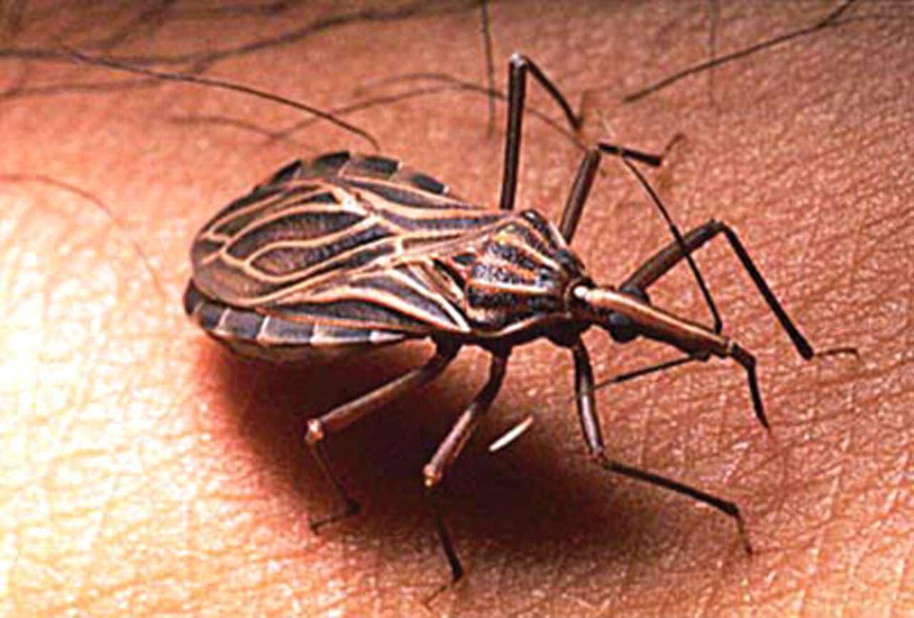 Chagas Disease