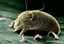 Dust mite allergy