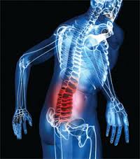 Ergonomic and Musculoskeletal Disorders