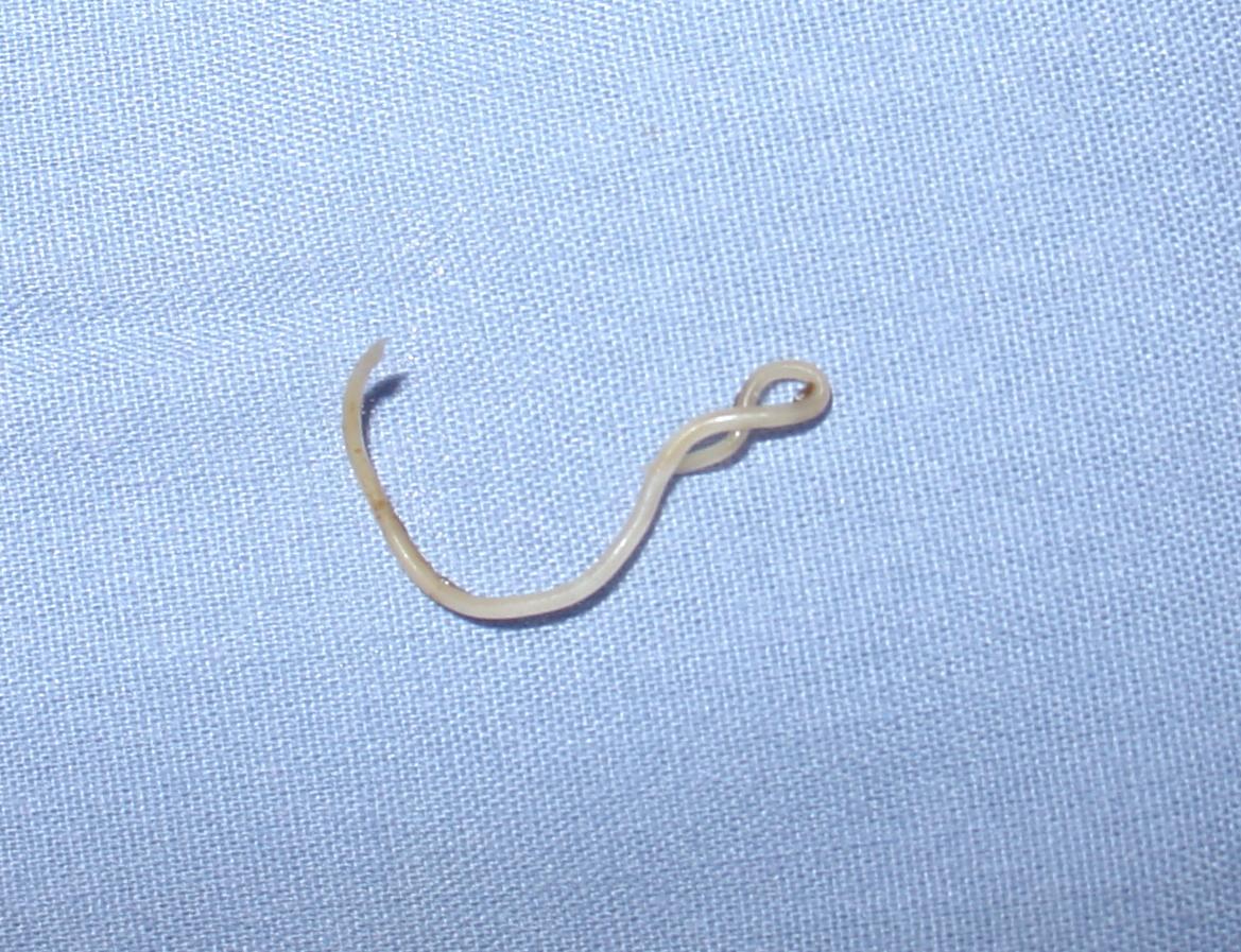 Human Hookworm | Canada| PDF | PPT| Case Reports | Symptoms | Treatment