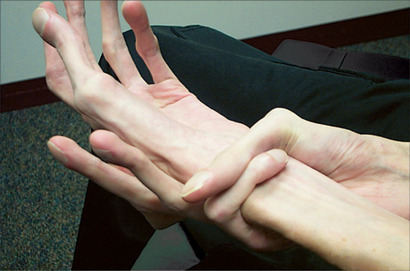 marfan-syndrome-44126.jpg