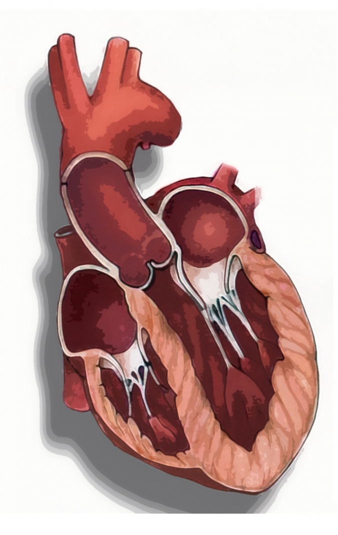 Myocarditis Sweden Pdf Ppt Case Reports Symptoms Treatment