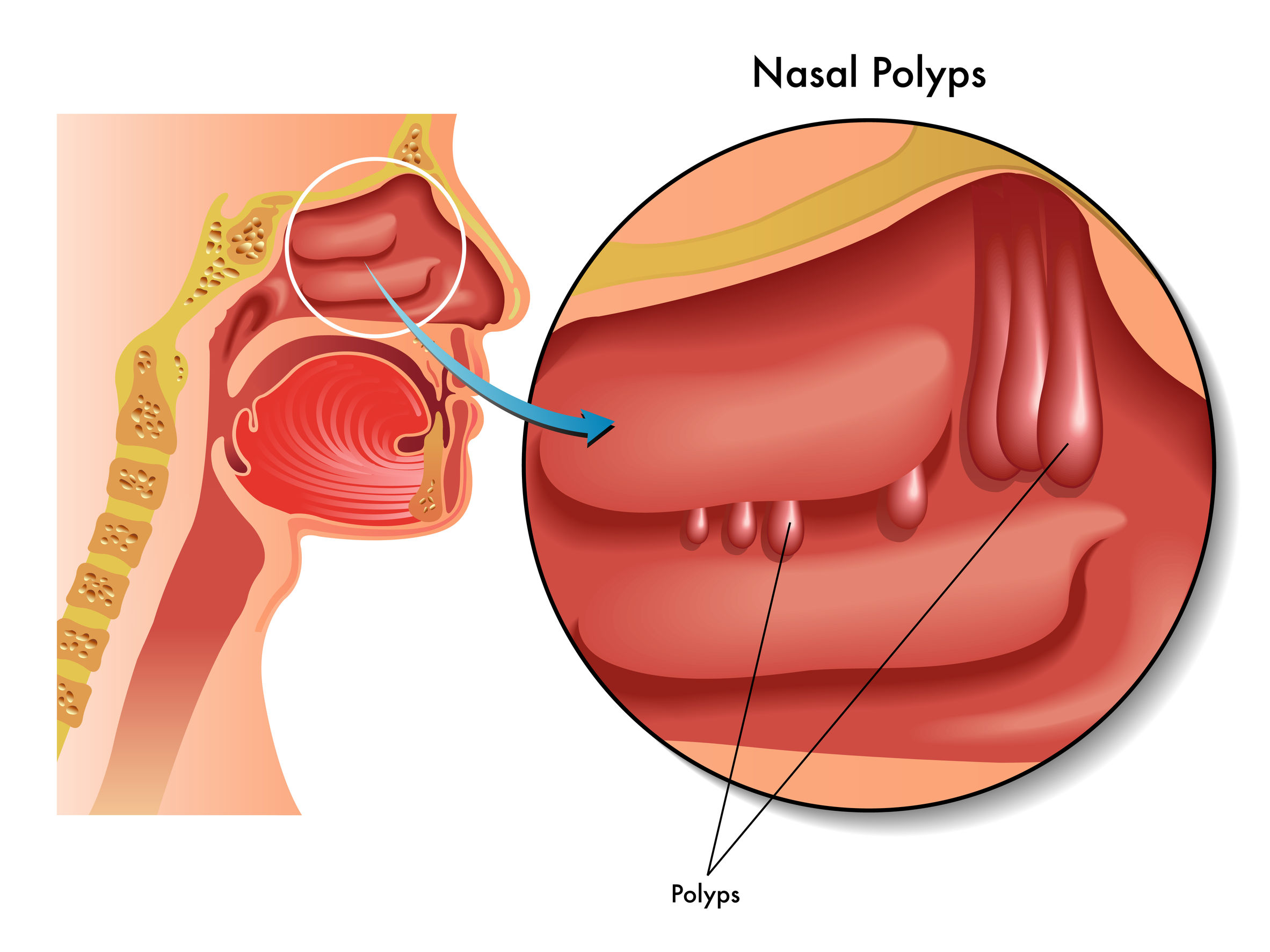 Are Nasal Polyps Common In Dogs