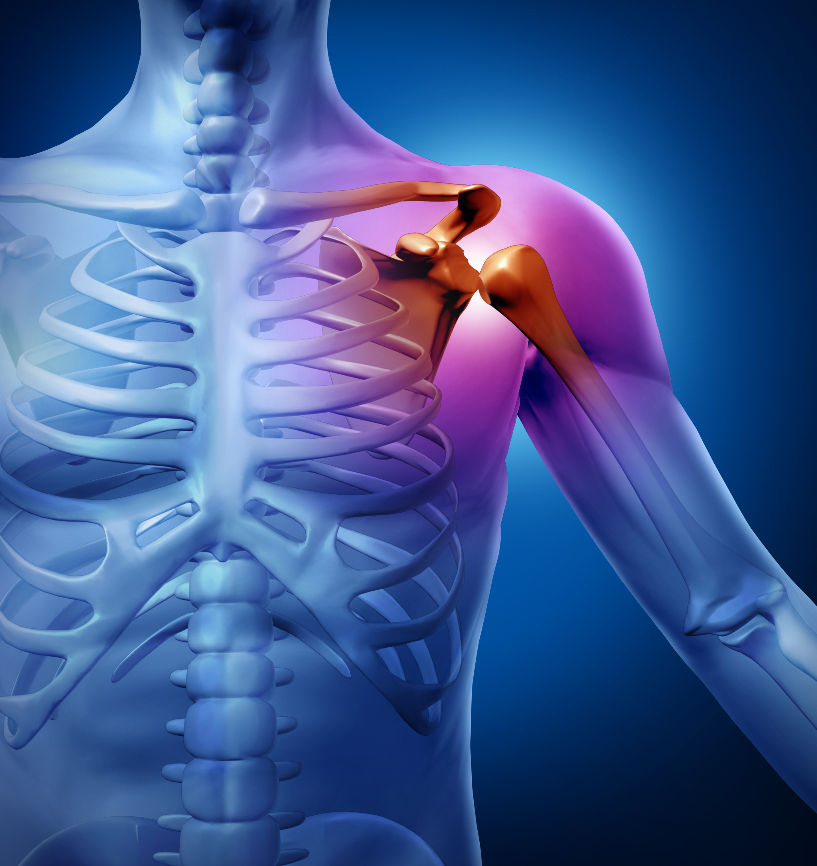 separated-shoulder-india-pdf-ppt-case-reports-symptoms-treatment