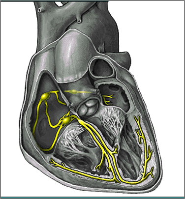 Sick Sinus Syndrome Ekg