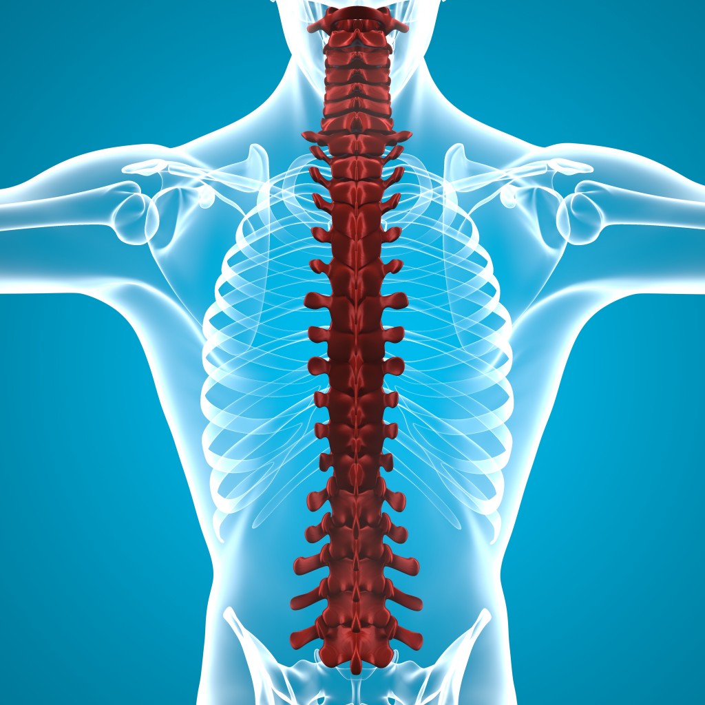 Spinal cord tumor